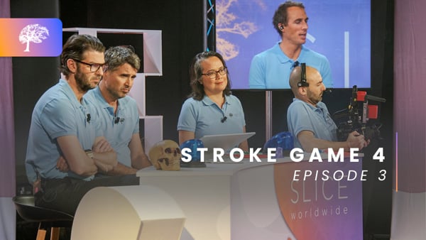Isolated carotid occlusion – to treat or not to treat? - Ep.3/3