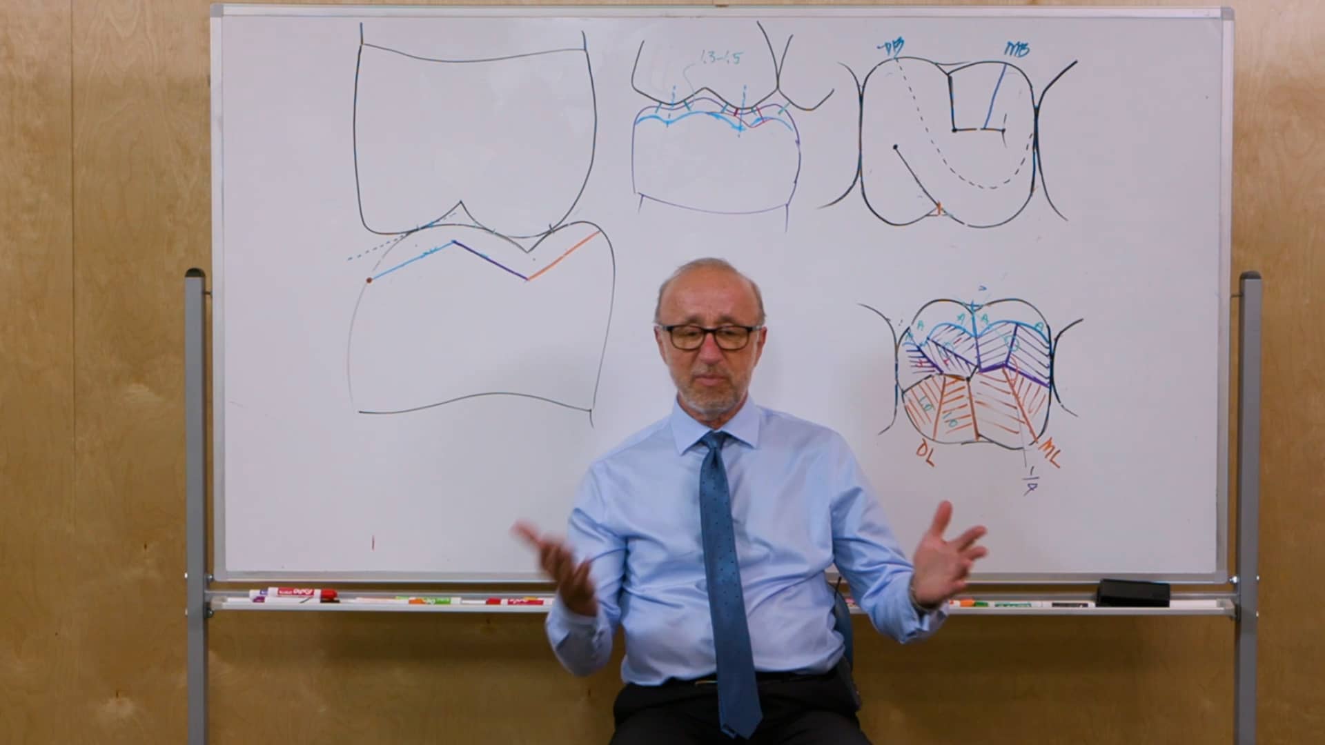 GOLD CROWN PREPARATIONS — Principles and Execution for Occlusal Reduction and Axial Reduction on