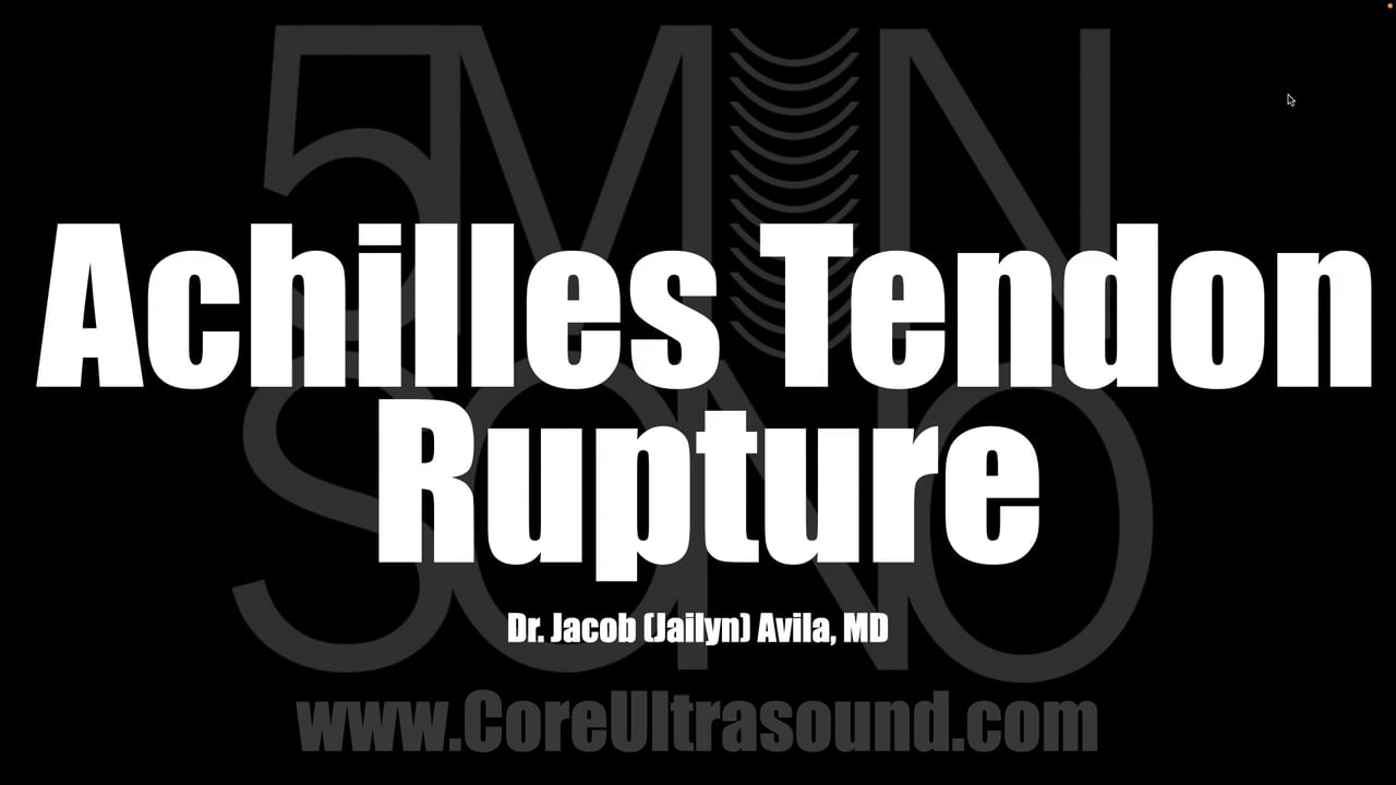 Image of Achilles Tendon Rupture