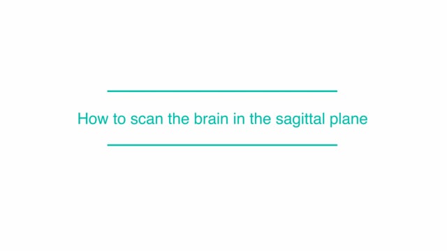 How to scan the brain in the sagittal plane