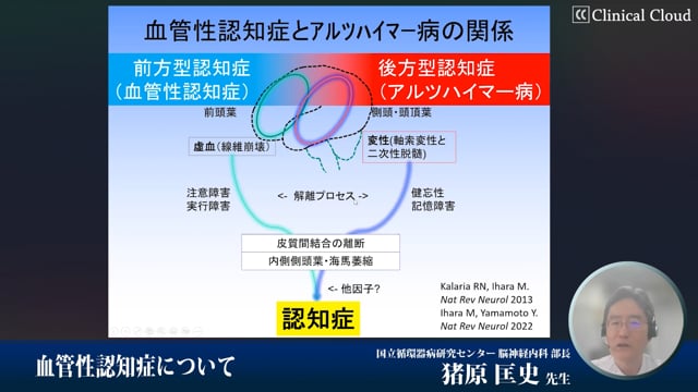 アルツハイマー病と血管性認知症の密接な関係性