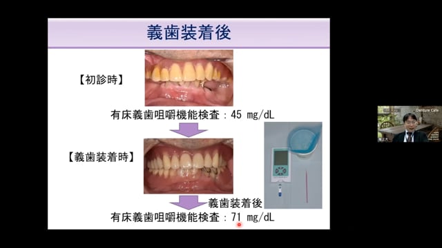 口腔機能リハビリテーションのススメ│竜 正大先生 #2