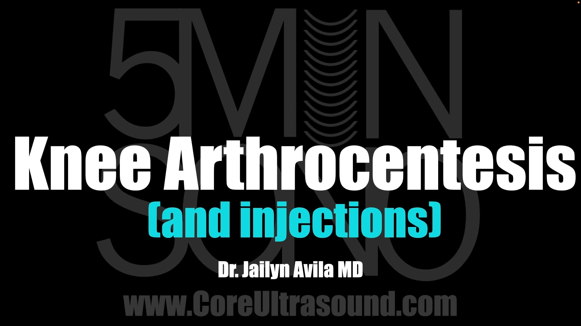 Image of Knee Aspiration and Injection