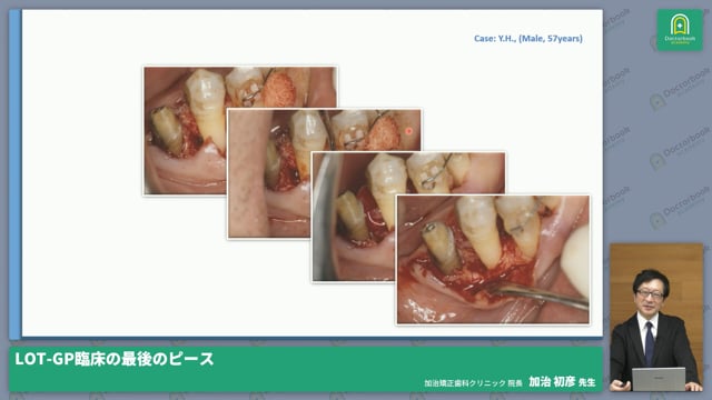 LOT-GP臨床の最後のピース