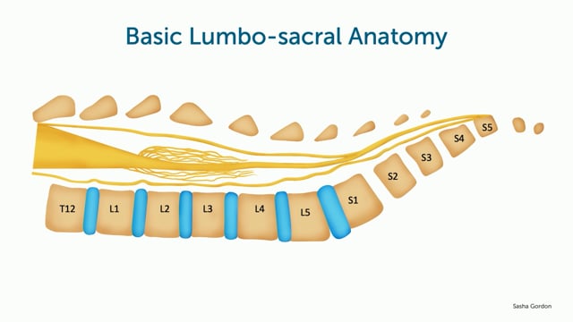 Lumbo-sacral vertebral ultrasound anatomy for neonatal spine ultrasound