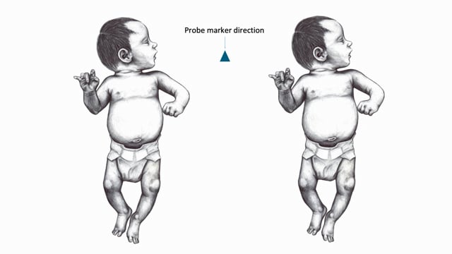 How to scan neonates and children using a systematic and comprehensive approach?