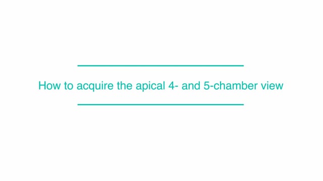 How to acquire the apical 4- and 5-chamber view