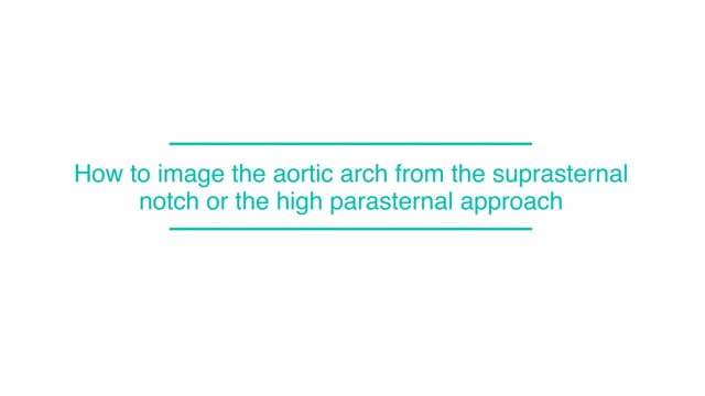 How to image the aortic arch from the suprasternal notch or the high parasternal approach