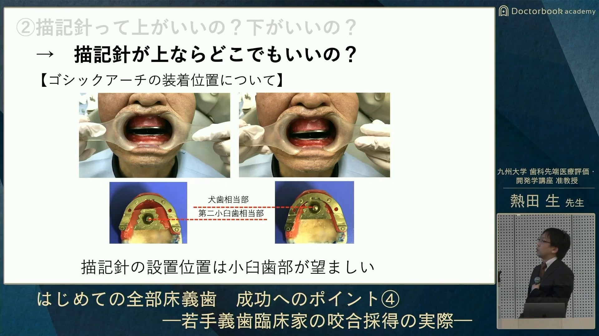 写真でマスターする 全部床義歯の印象 咬合採得 試適・装着 裁断済み