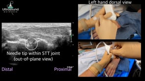 STT Joint Injection