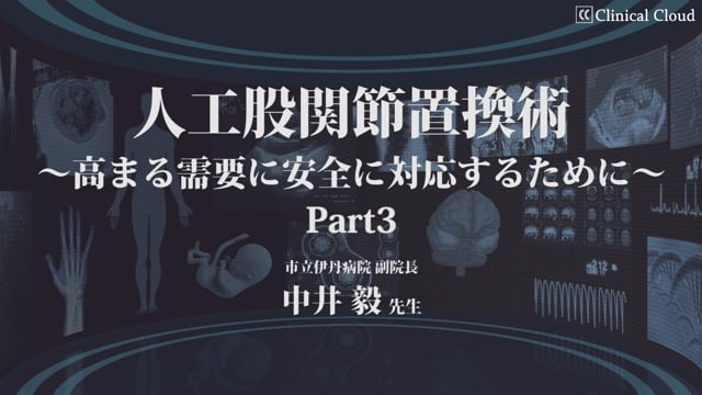 人工股関節置換術〜高まる需要に安全に対応するために〜 Part3