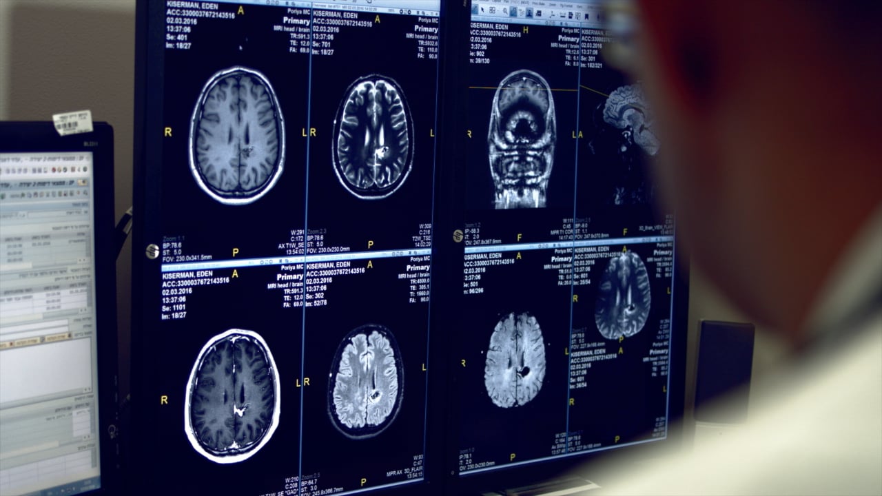 Elements Support Services - Acquired Brain Injury on Vimeo