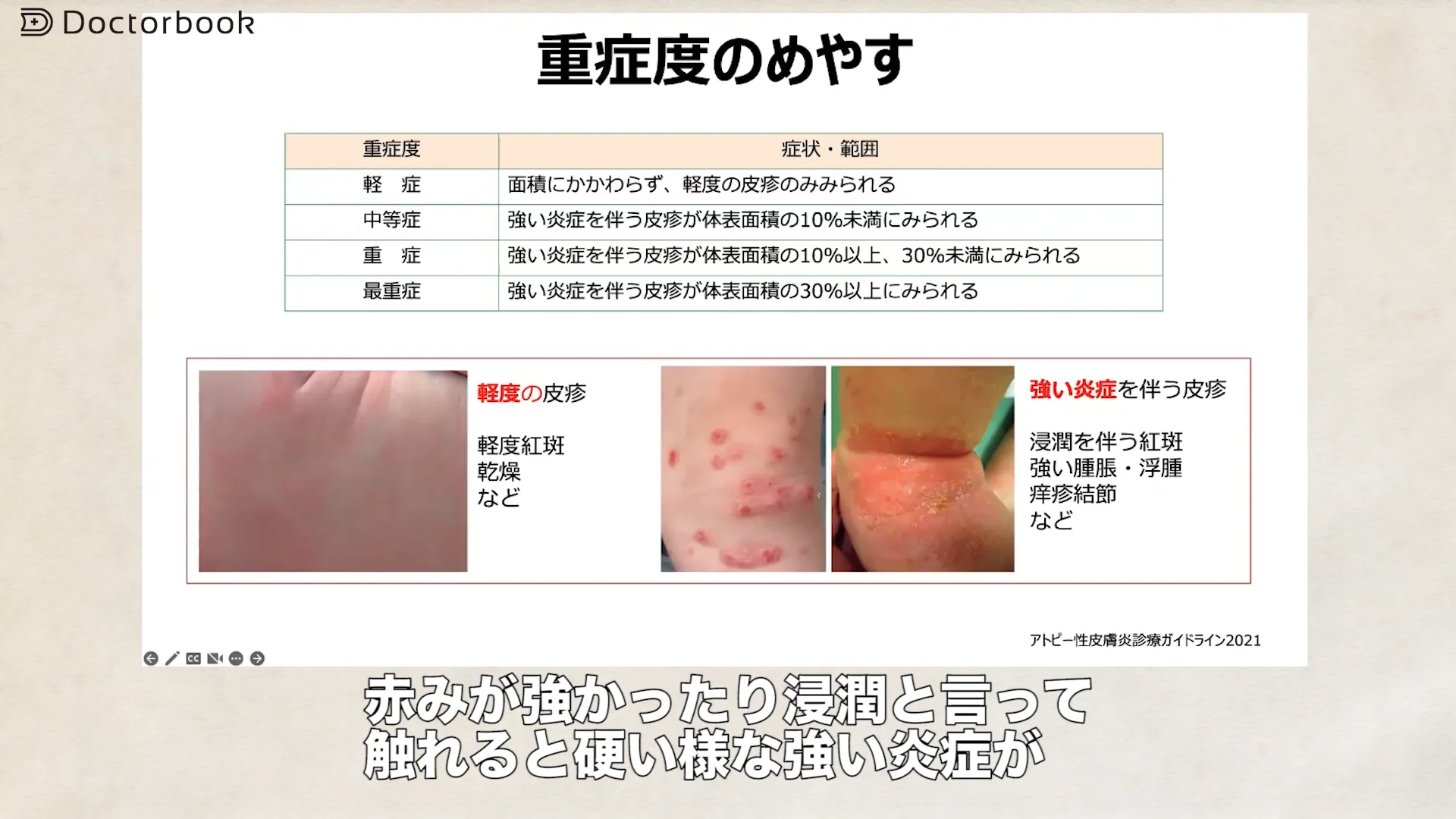 医師出演】アトピー性皮膚炎の診断・治療について | Doctorbook