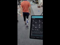 Newswise:Video Embedded ai-based-prosthetic-socket-developed-to-help-thigh-amputees