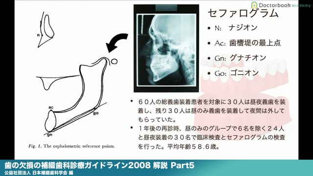 『歯の欠損の補綴歯科診療ガイドライン2008』解説 Part5