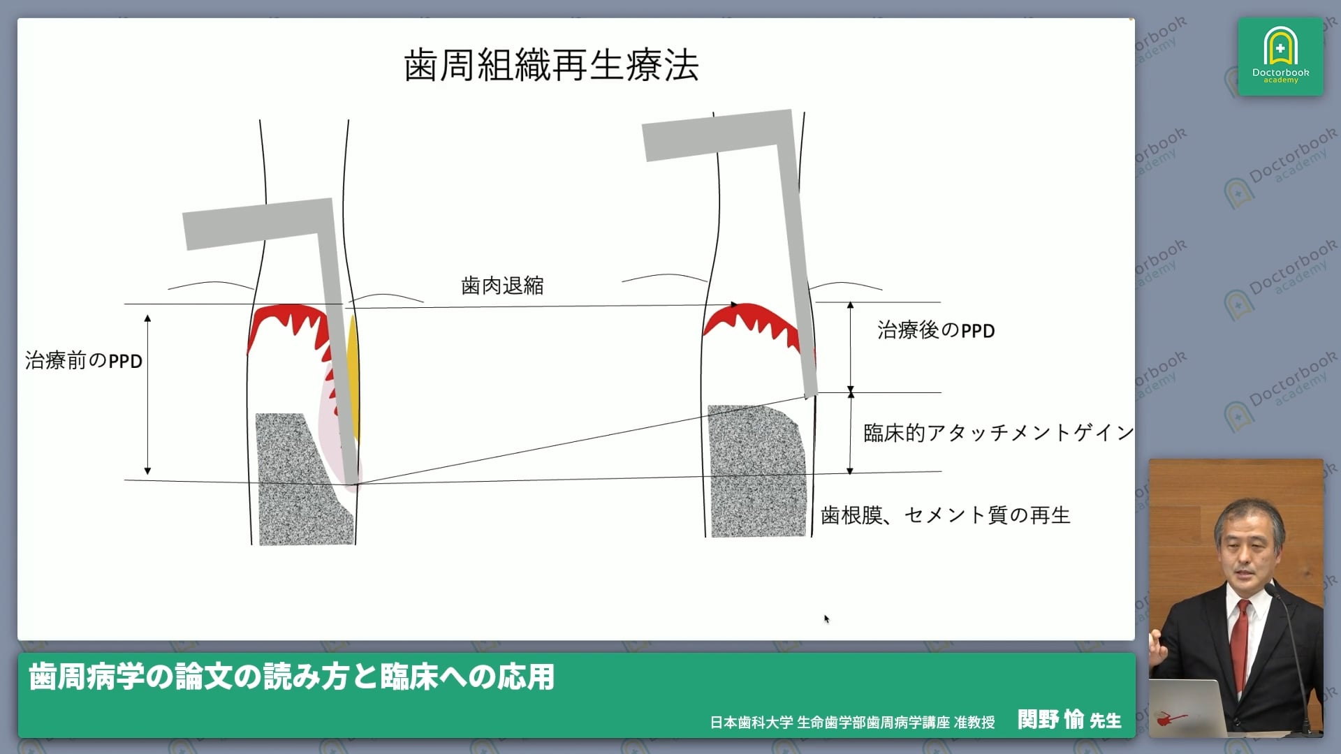 Part1 論文を読むための予備知識：#2 臨床研究のデザインと評価項目