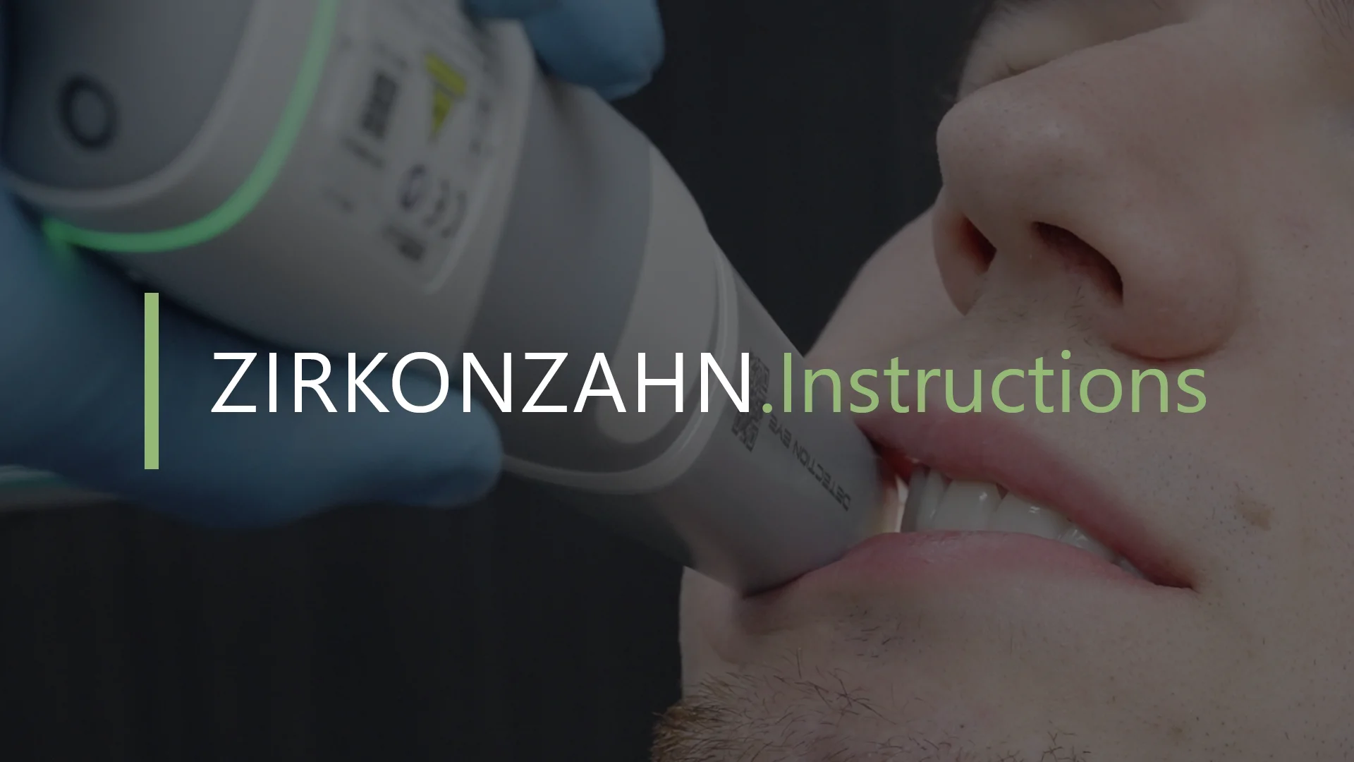 Detection Eye Intraoral Scanner