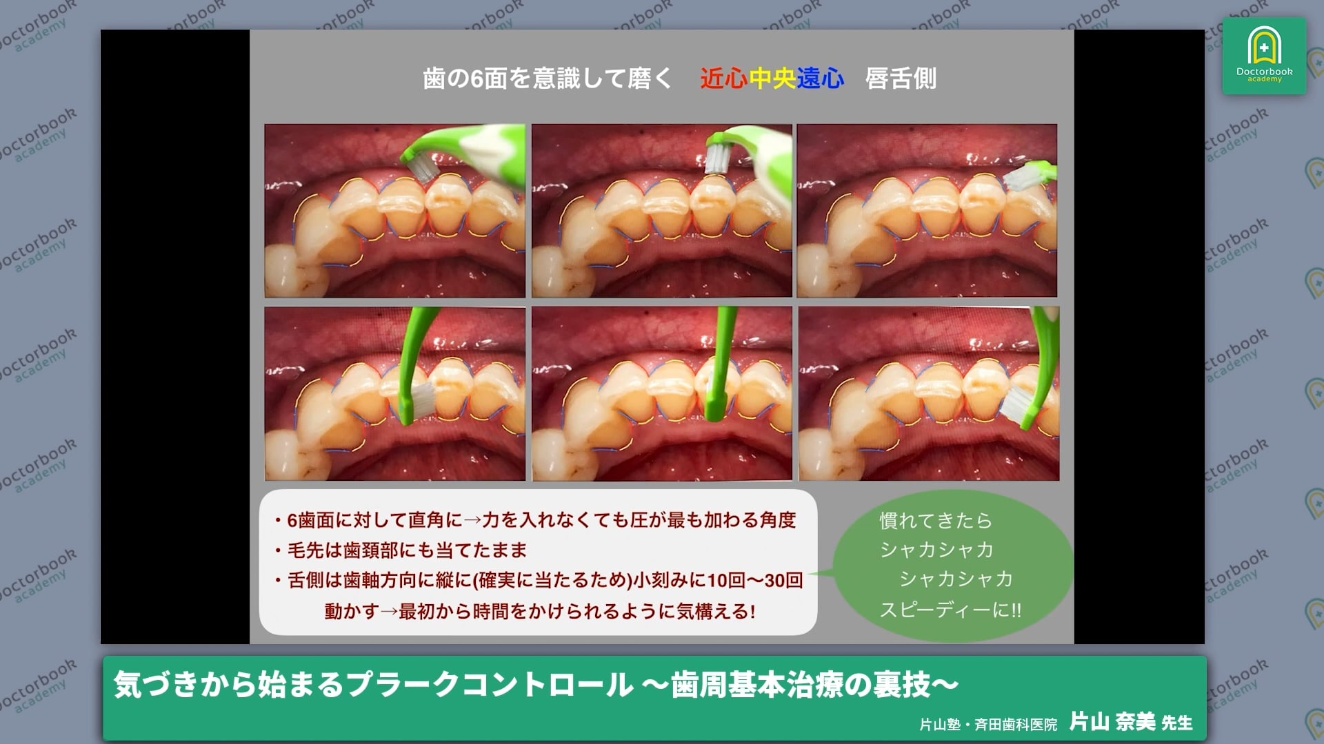 気づきから始まるプラークコントロール〜歯周基本治療の裏技〜