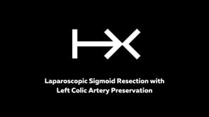Laparoscopic Sigmoid Resection with Left Colic Artery Preservation for Malignant Polyp Using HandX Monopolar Hook