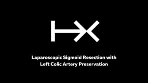 Laparoscopic Sigmoid Resection with Left Colic Artery Preservation for Malignant Polyp Using HandX Monopolar Hook