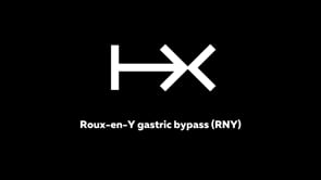 Roux-en-Y gastric bypass (RNY) Internal and external view
