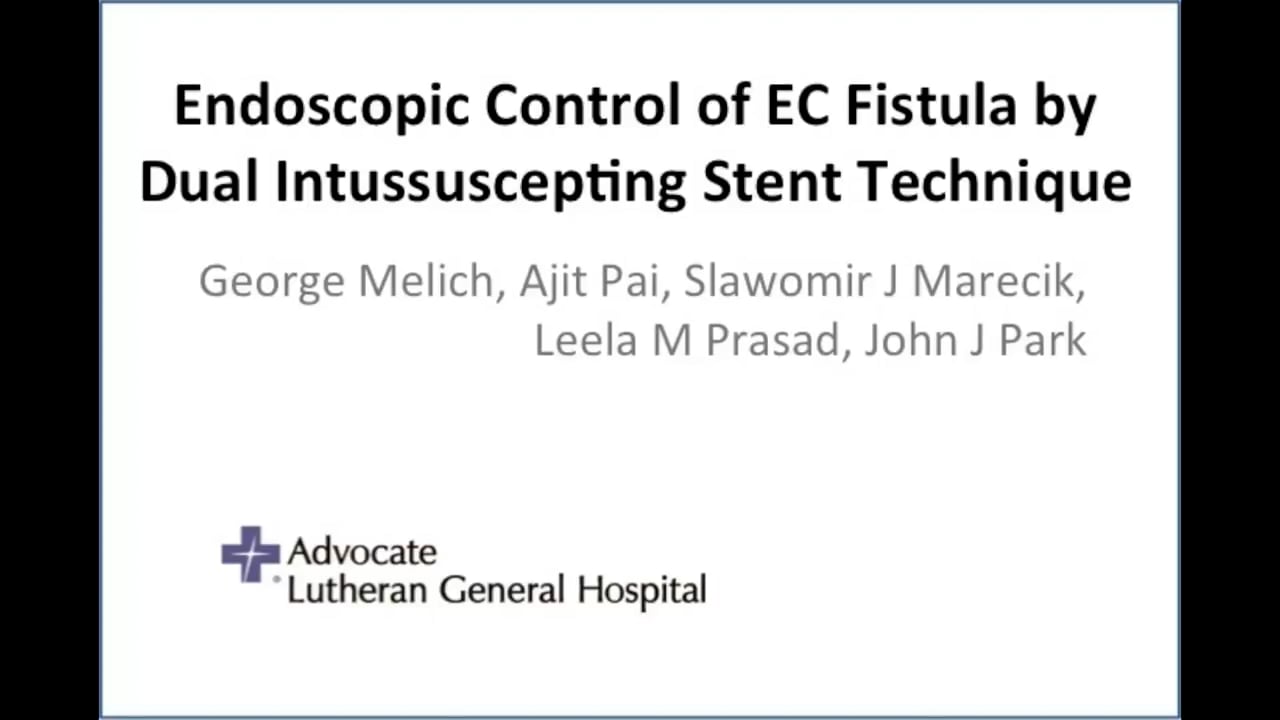 v056-endoscopic-control-of-enterocutaneous-fistula-by-dual