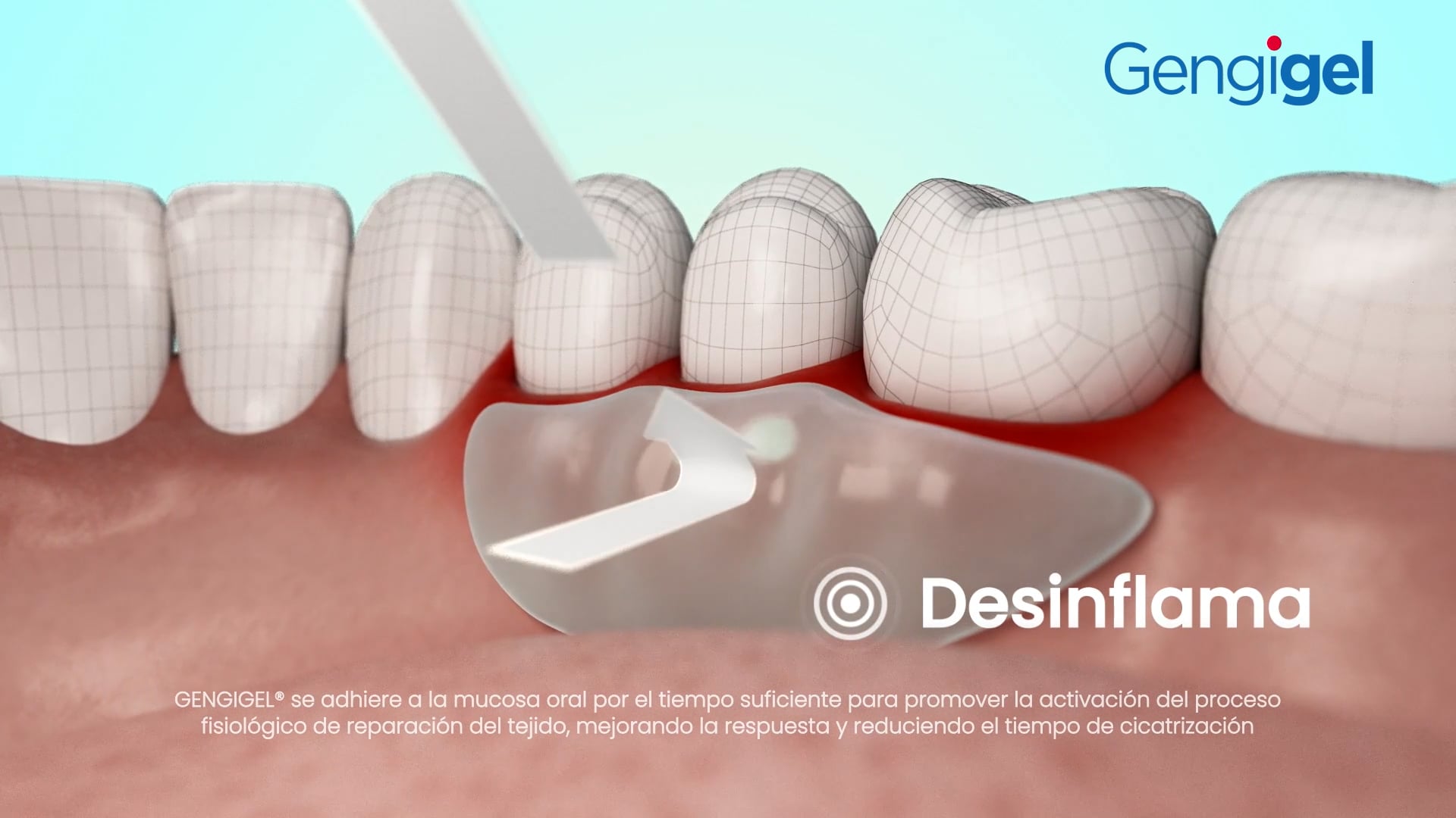 Comercial Gengigel