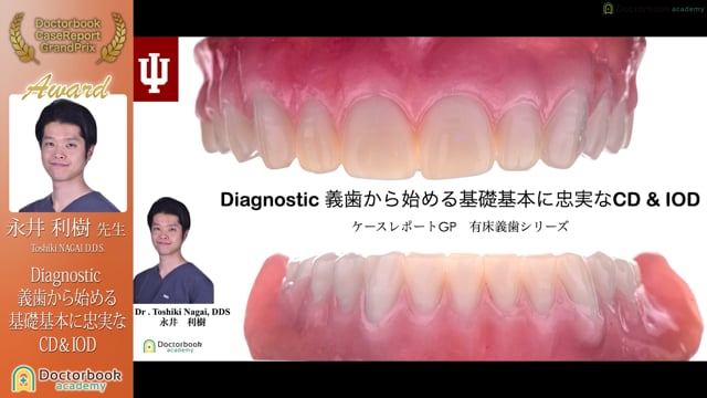 【ケースレポートGP2022有床義歯セッション☆AWARDS 激励賞☆】永井利樹先生「Diagnostic 義歯から始める基礎基本に忠実なCD&IOD」