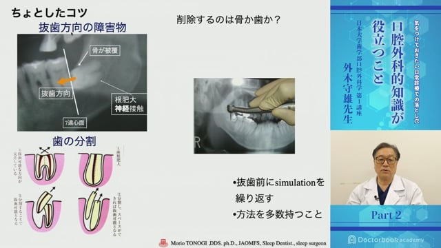 科学的根拠に基づいた ビジュアル下顎埋伏智歯抜歯」 裁断済 | rucol.cl