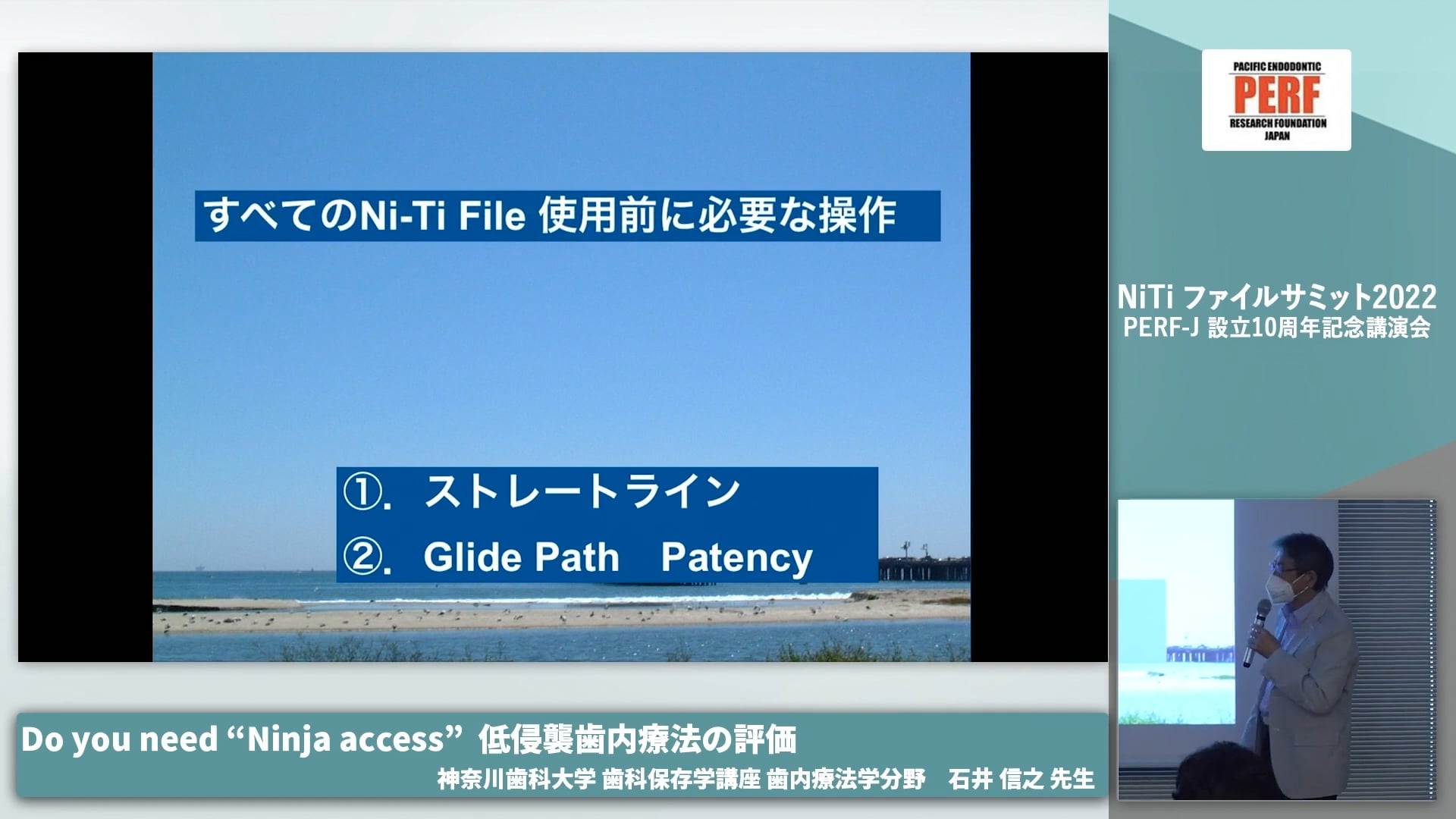  臨床知見録_ニッケルチタン_Ni−Ti File 使用前に必要なこと