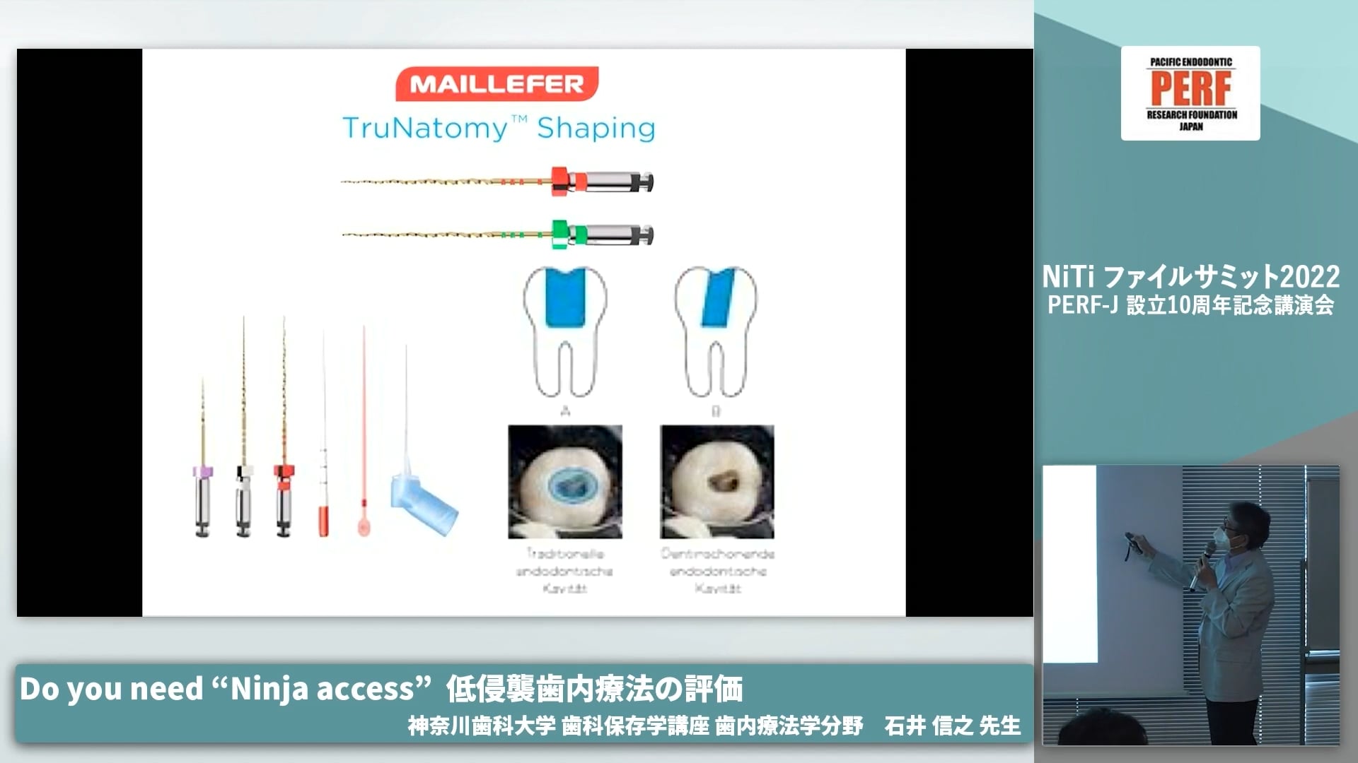  臨床知見録_ニッケルチタン_TruNatomyファイルの説明