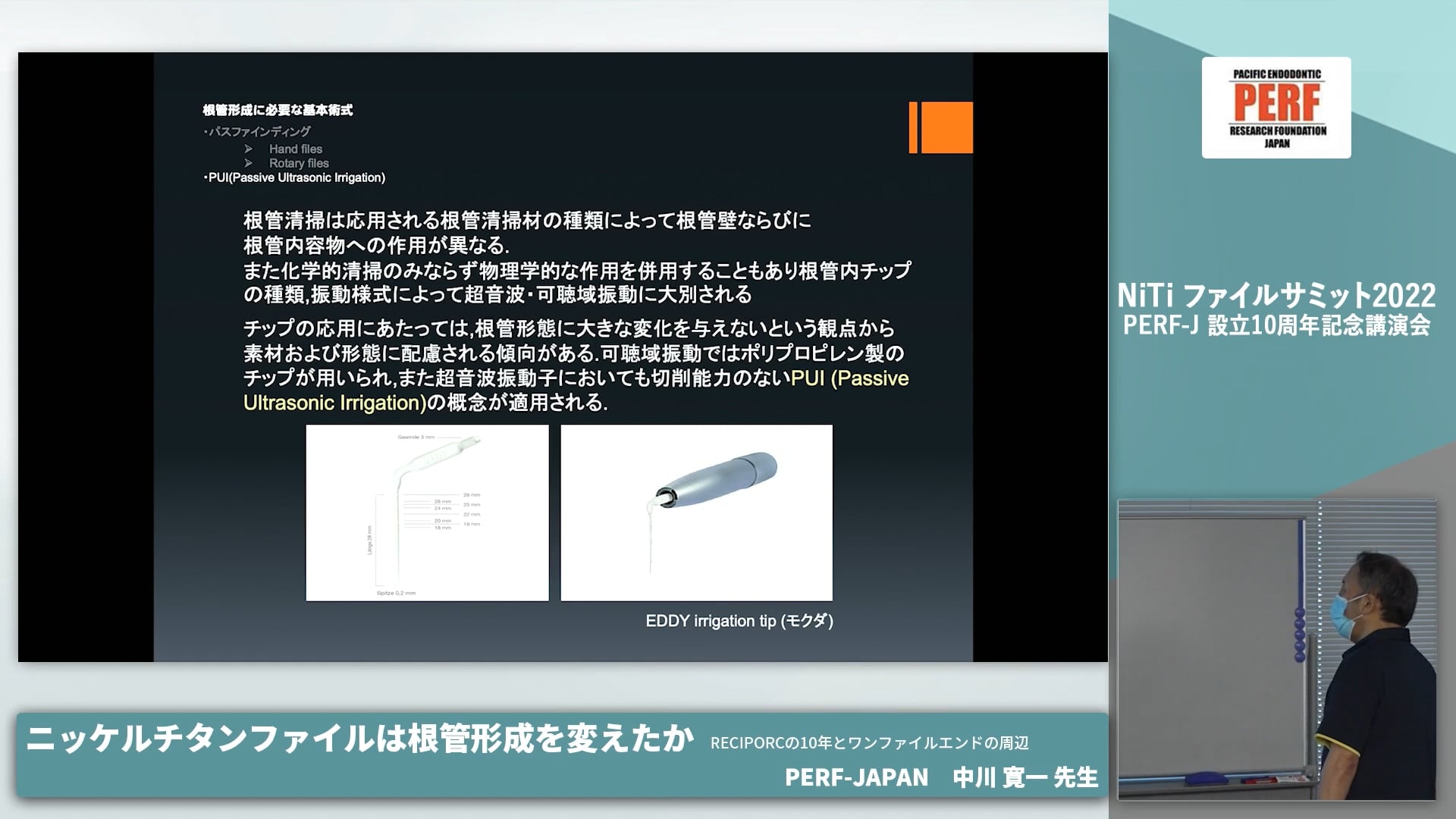  臨床知見録_ニッケルチタン_PUI(Passive Ultrasonic irrigation)