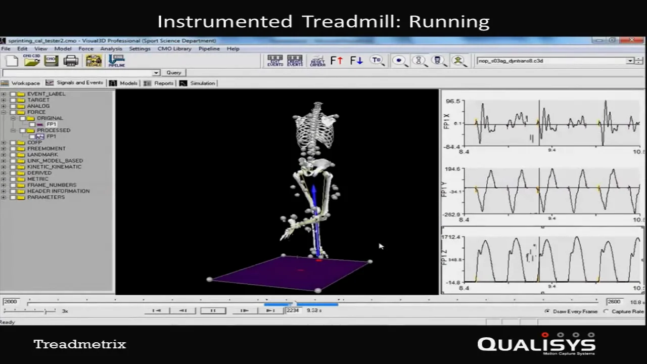 VIdeos Archives - Anatomy Trains
