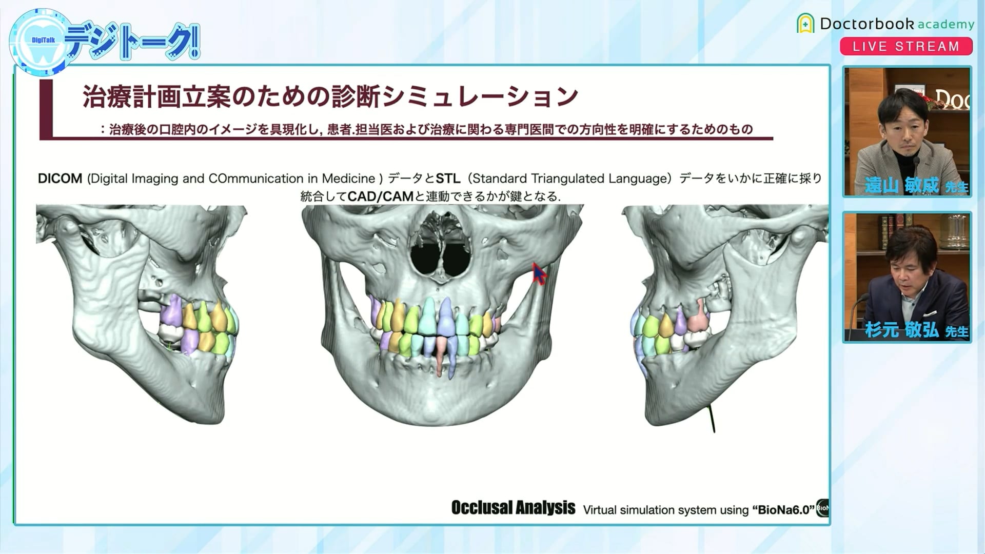 進化し続けるMulti-Digital Dentistryの歯科臨床：インプラント編
