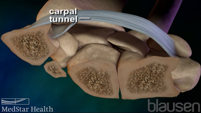 ipamorelin side effects carpal tunnel How L-Carnitine Helps with Fat Metabolism