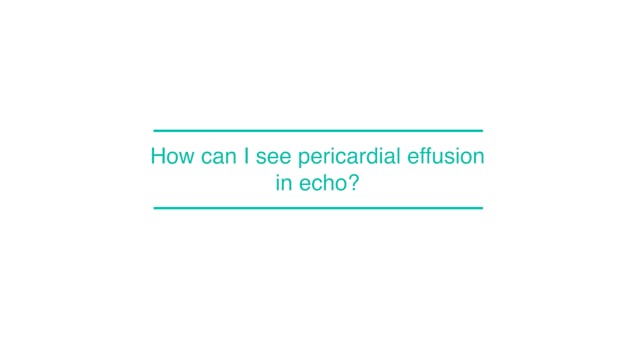 How can I see pericardial effusion in echo?