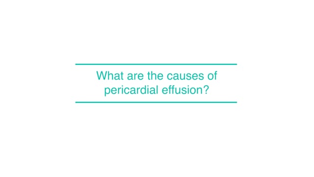 What are the causes of pericardial effusion?