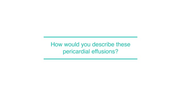 How would you describe these pericardial effusions?