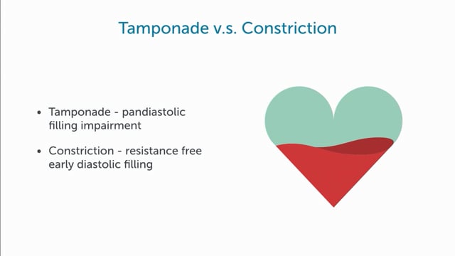 What is the difference between cardiac tamponade and restrictive pericarditis?