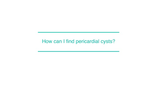 How can I find pericardial cysts?