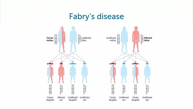 What is Fabry´s disease?