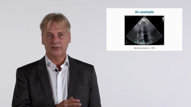 Diastolic dysfunction in echocardiography