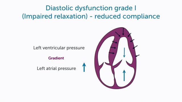 What is diastolic dysfunction grade I?