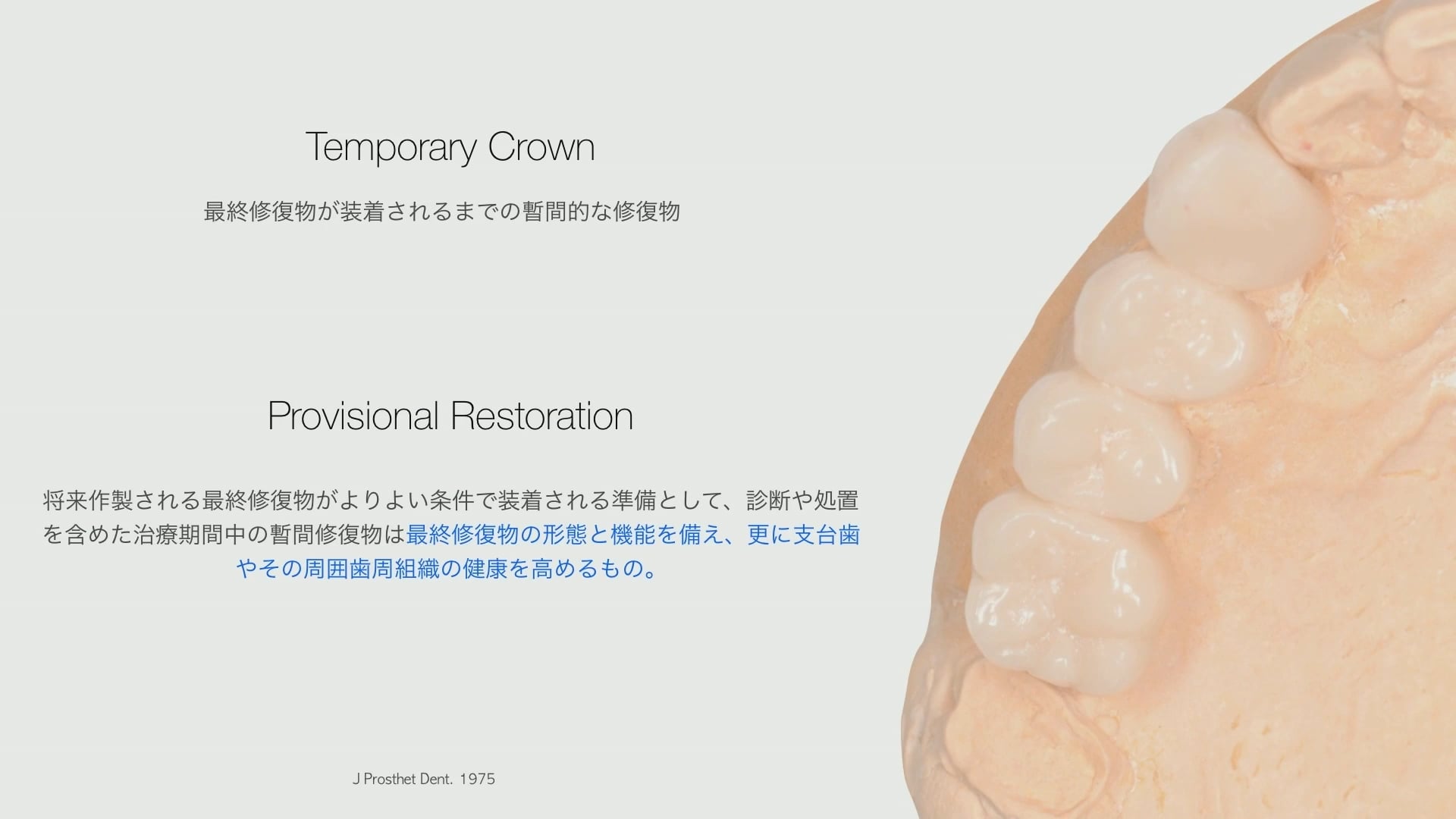 臨床知見録_プロビジョナル_テンポラリークラウンと プロビジョナルレストレーション