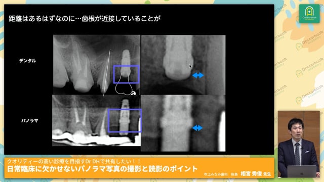 クオリティーの高い診療を目指すDr DHで共有したい！日常臨床に欠かせないパノラマ写真の撮影と読影のポイント