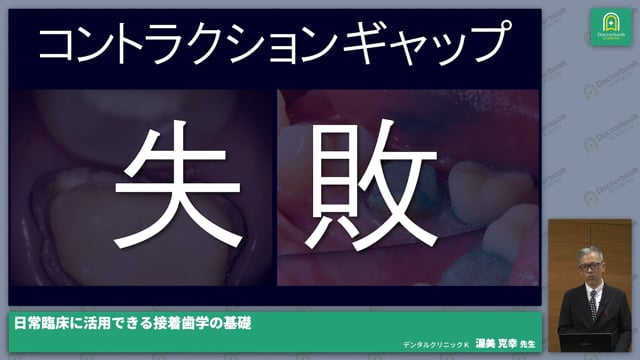 日常臨床に活用できる接着歯学の基礎│CRコングレス～CR・接着の真価を再考する～