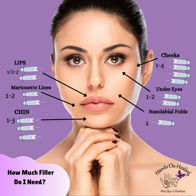 What you need to know about Dermal Filler