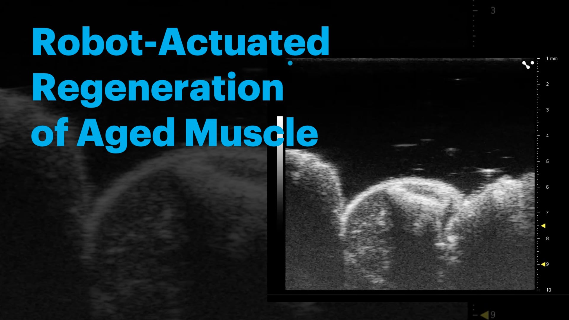 Robot-Actuated Regeneration of Aged Muscle