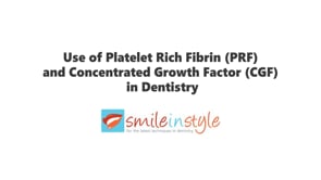 PRF & CGF Therapy