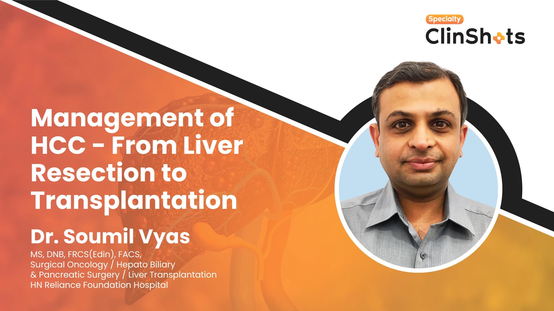 Management of HCC – From Liver Resection to Transplantation